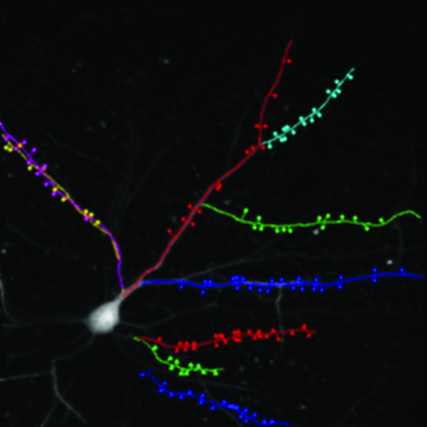 A Single Nerve Cell in the Cortex of a Live Mouse