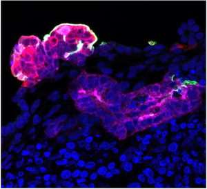 Human Kidney Organoid.