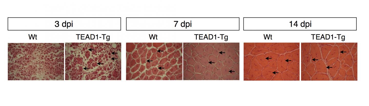 Normal and Genetically Modified Muscle Tissue