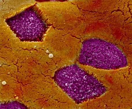 M Cells