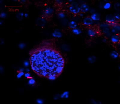 Toxoplasma Cyst