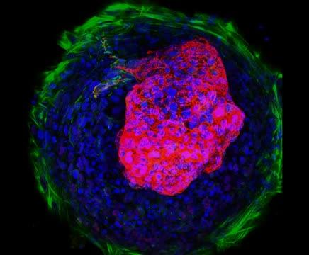 Microchamber