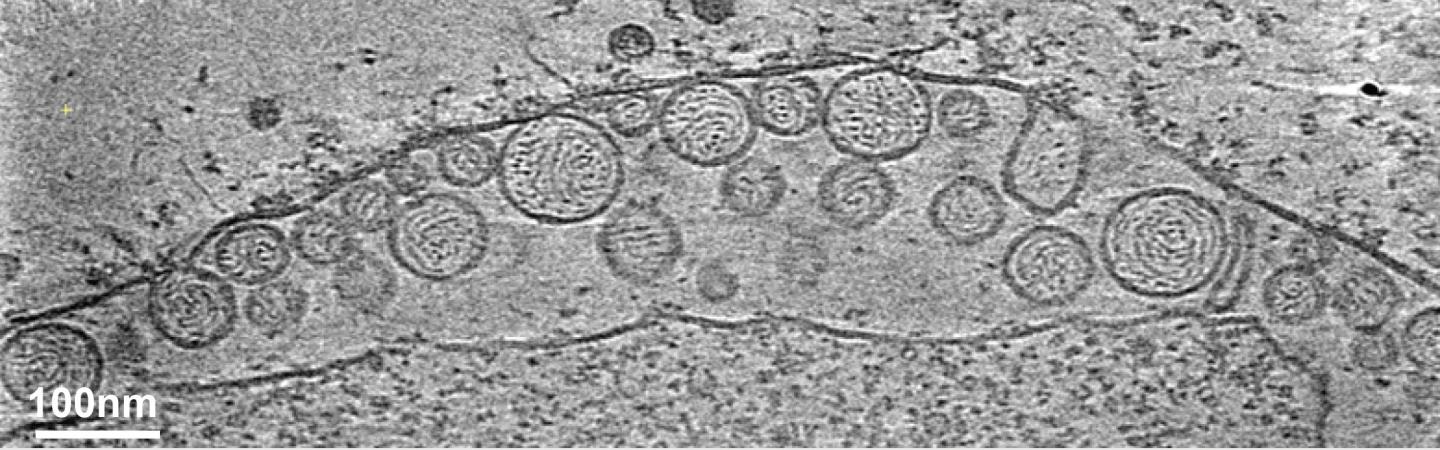 Cryo-ET Image of Replication Spherules