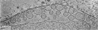 Cryo-ET Image of Replication Spherules