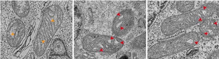 Turning off the ALKBH1 gene damages the inner folds of mitochondria, showing its importance for keeping these cellular “power plants” healthy.