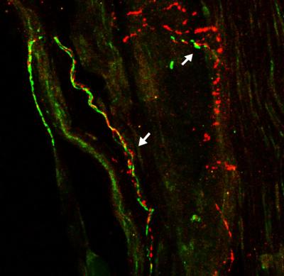 Nerve Fibers