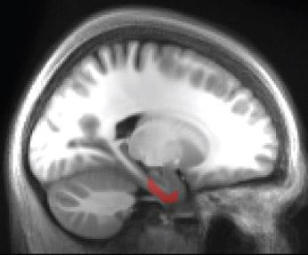 Entorhinal Cortex