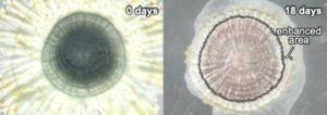 Ring growth