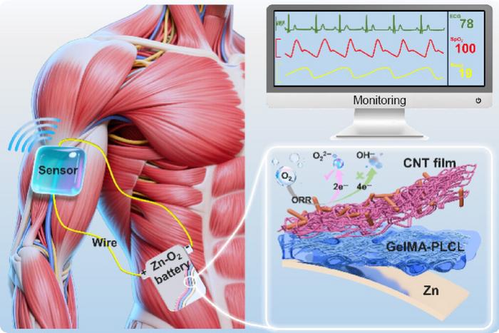 Designing bio-compatible gel electrolyte for implantable Zn-O2 battery.