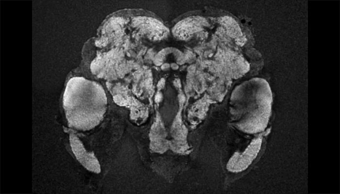 Mosquito Brain Map
