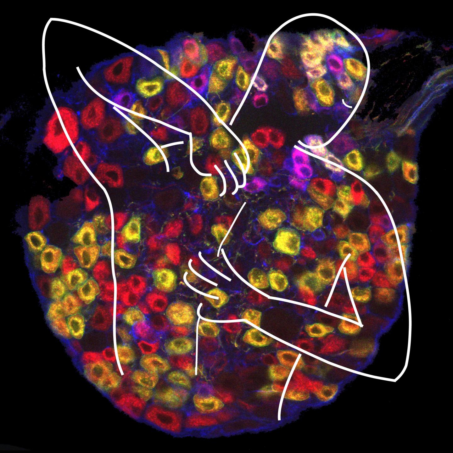 Itch Neurons