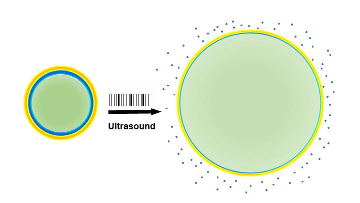Ultrasound