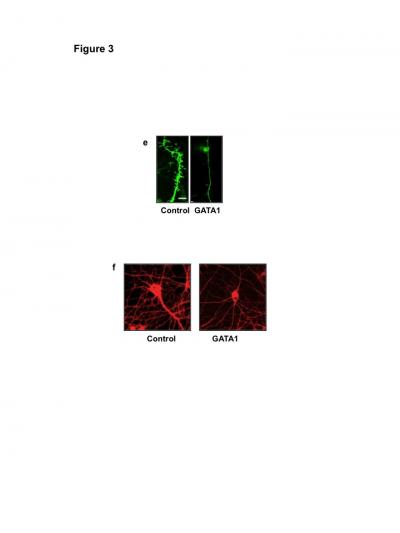 How Stress Shrinks Synapses