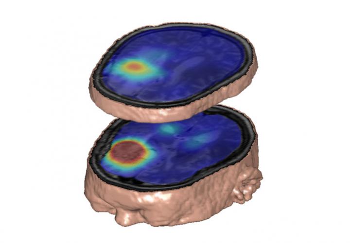 A New Approach for Imaging Metabolism In Vivo (2 of 2)