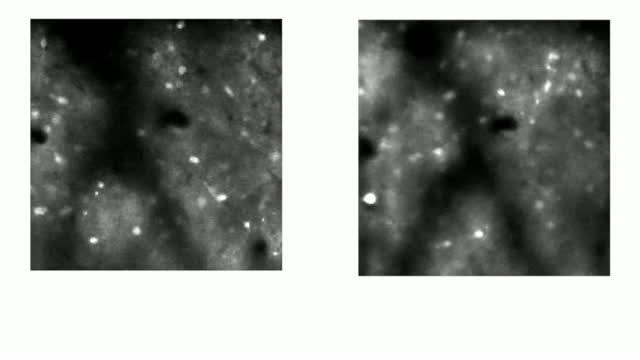 Video: Neurons Firing in Healthy Mice Vs. Two Mouse Models of Schizophrenia