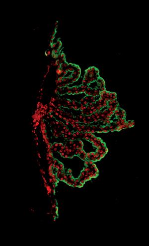 Choroid Plexus