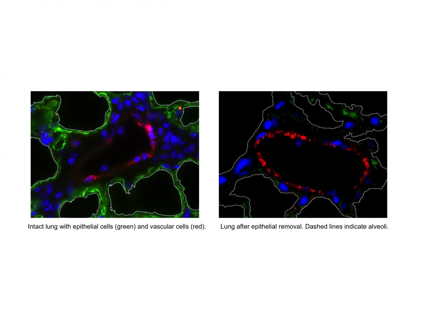 Functional Vascularized Graft for Lung Bioengineering 