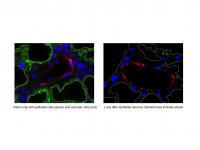 Functional Vascularized Graft for Lung Bioengineering 