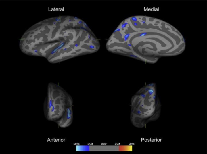 Brain Scans