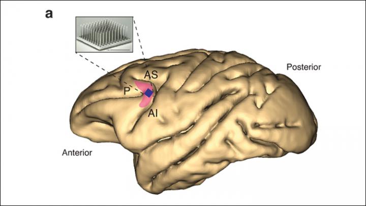 Neurophysiological Recordings