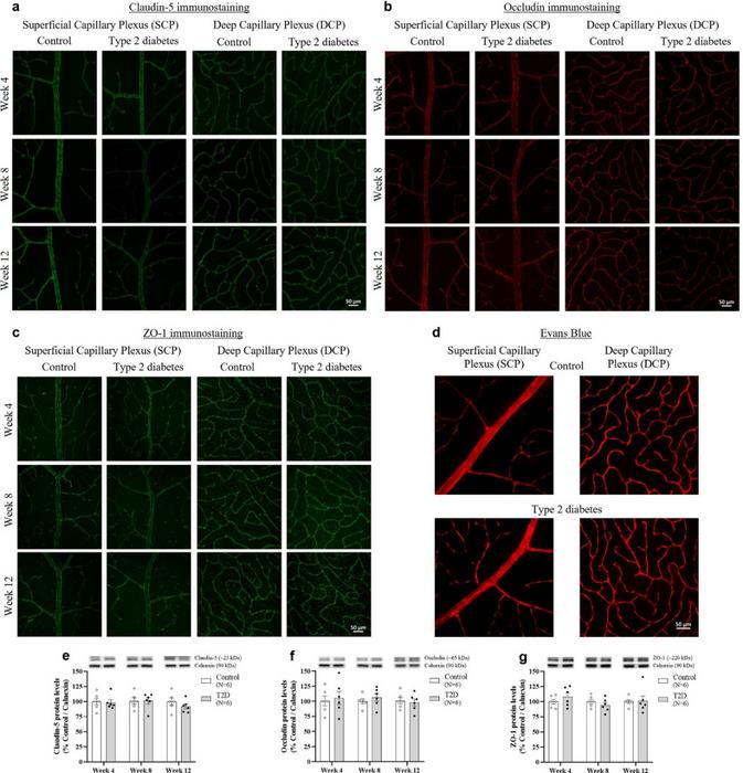 Diabetes triggers slight immunoreactive changes in tight junction proteins, without changes in retinal vascular permeability.