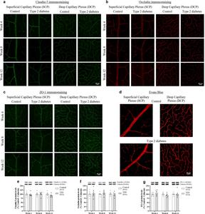 Diabetes triggers slight immunoreactive changes in tight junction proteins, without changes in retinal vascular permeability.