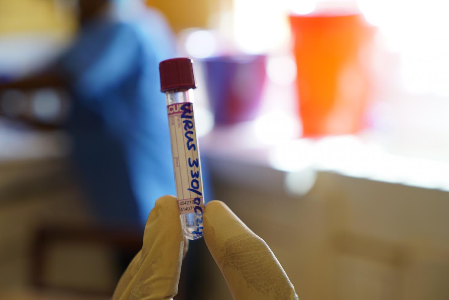 Ebola Vial