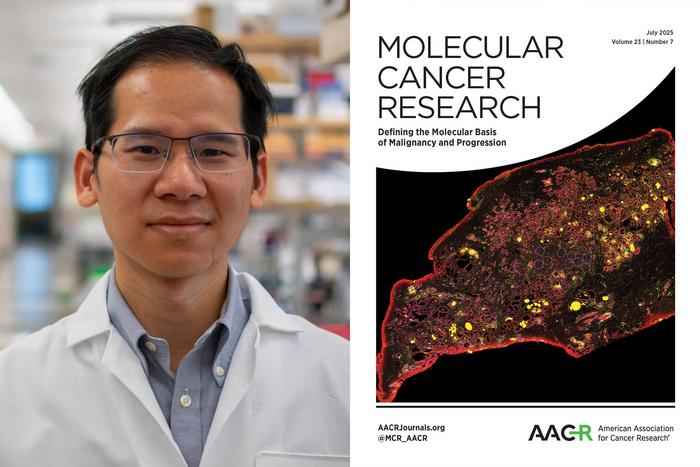 Prostate cancer research