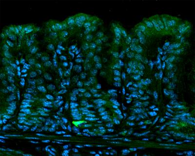 Stomach Stem Cells