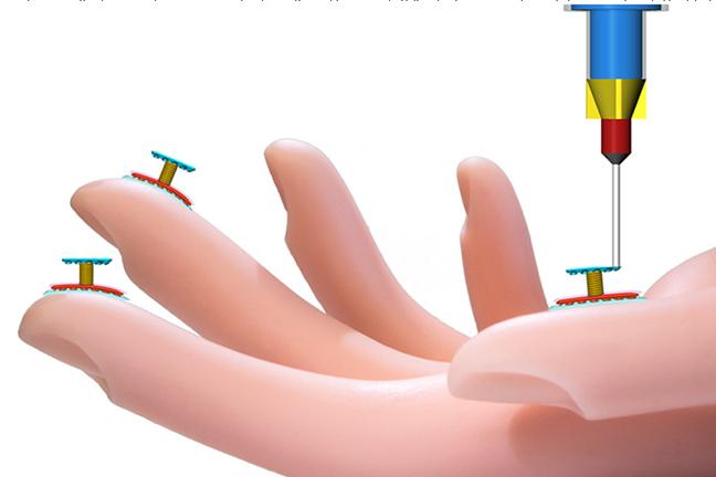 3-D Printer Built at the University of Minnesota Can Print Touch Sensors Directly on a Model Hand