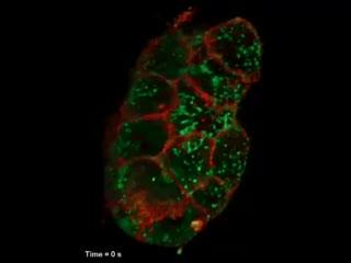 Under the Microscope, Shape-Shifting Cells (5 of 5)