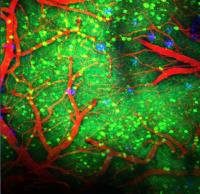 Neural imaging