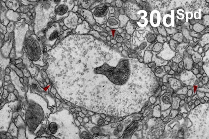 Keeping Your Synapses Sharp: How Spermidine Reverses Age-Related Memory Decline