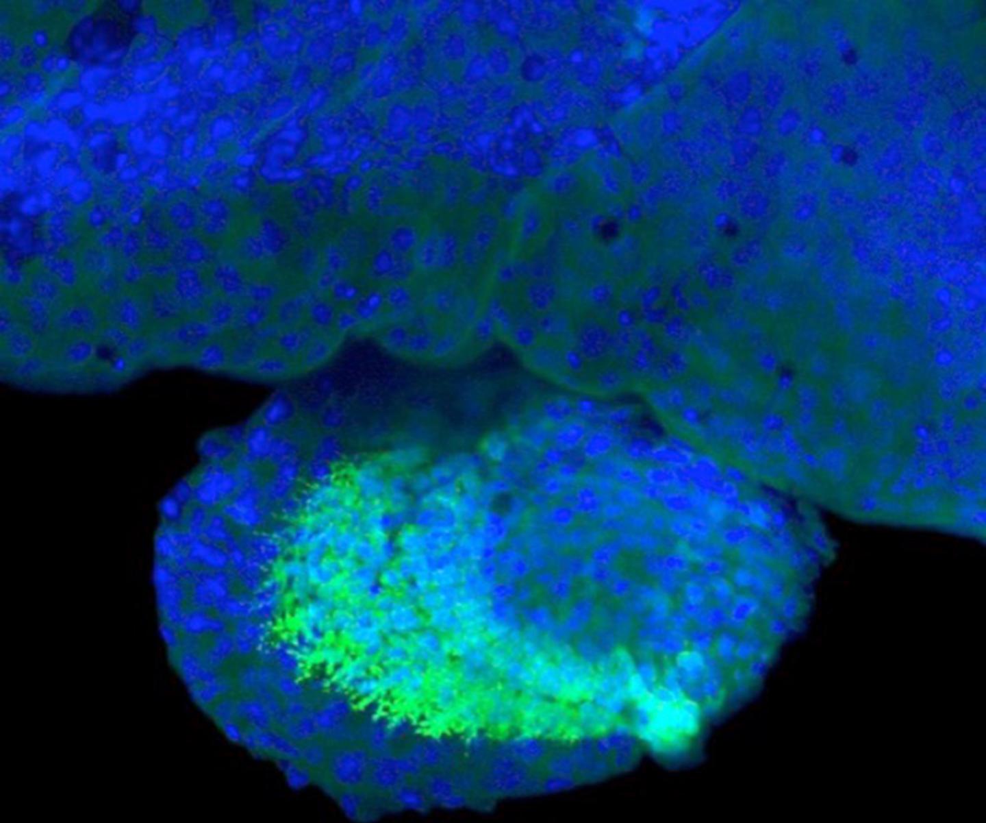 Genetic Switches in Gar Genome Drive Gene Activity