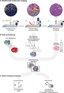 Construction of the FTU lipid atlas of the human kidney.