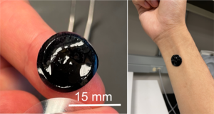 EEG electrode 2