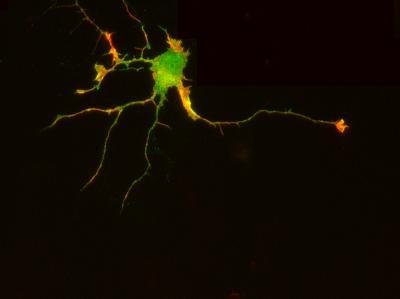 Eph-Receptors