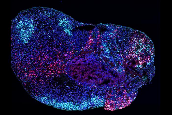 human stem cell-derived hippocampal assembloid