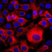 KRAS Cytoplasm