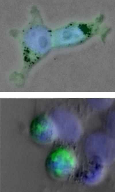ALS Protein
