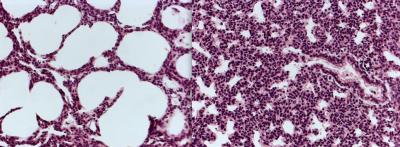 Lung Tissue