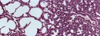 Lung Tissue