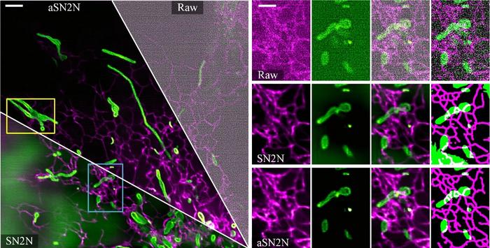 aSN2N enables artifact-free background for accurate segmentation of mitochondria and ER
