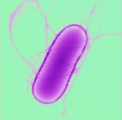 <i>Salmonella typhimurium</i>