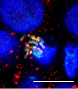 Autophagy Attacks Salmonella