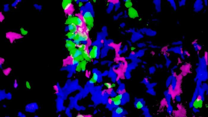 Digit T cells killing progenitor cells
