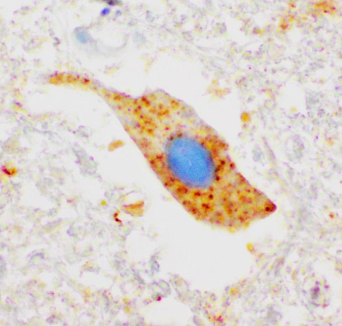Protein Clumps