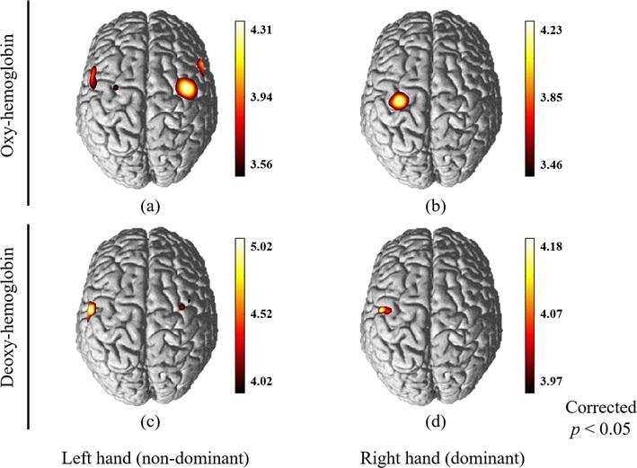 Cerebral Cortex Patterns