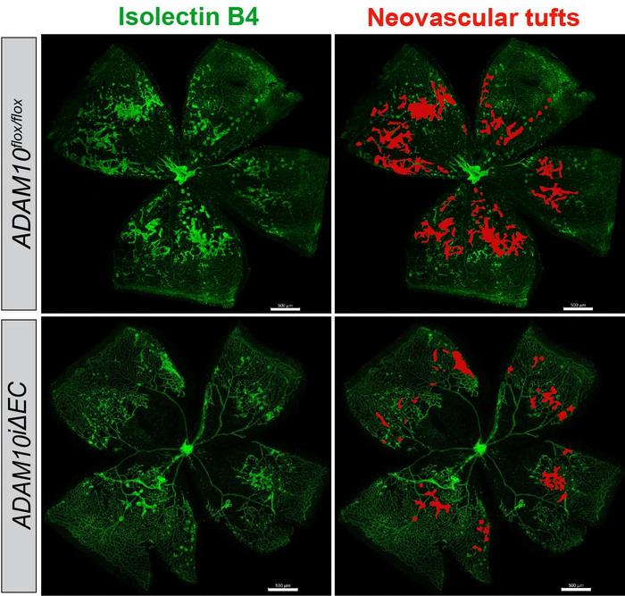 Novel Study Uncovers the Critical Role of ADAM10 Protein in the Development of Retinal Disorders