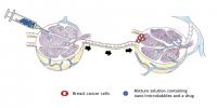 Attacking Metastatic Breast Cancer with Sound